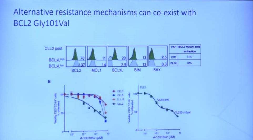 Specific BCL2 mutation confers resistance to venetoclax in progressive CLL