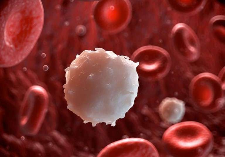 MDS diagnosis and prognosis with John Bennett